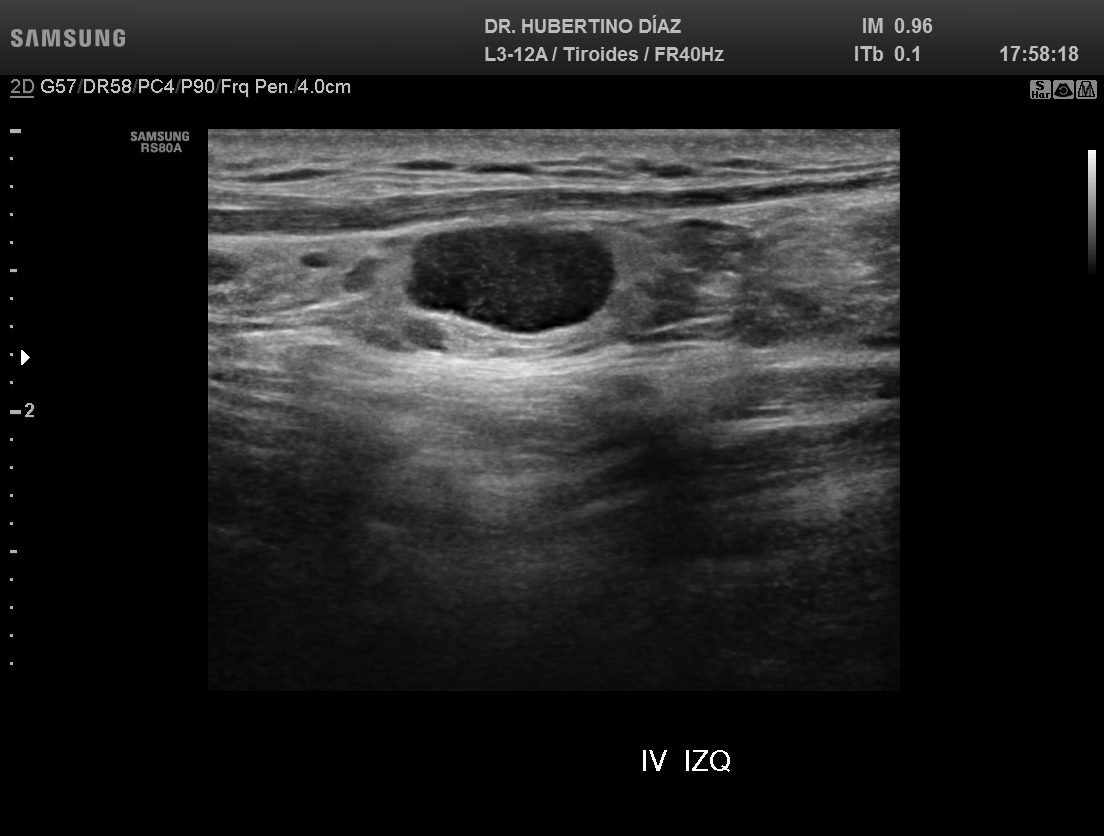 ECOGRAFÍA DE CUELLO - CERVICAL